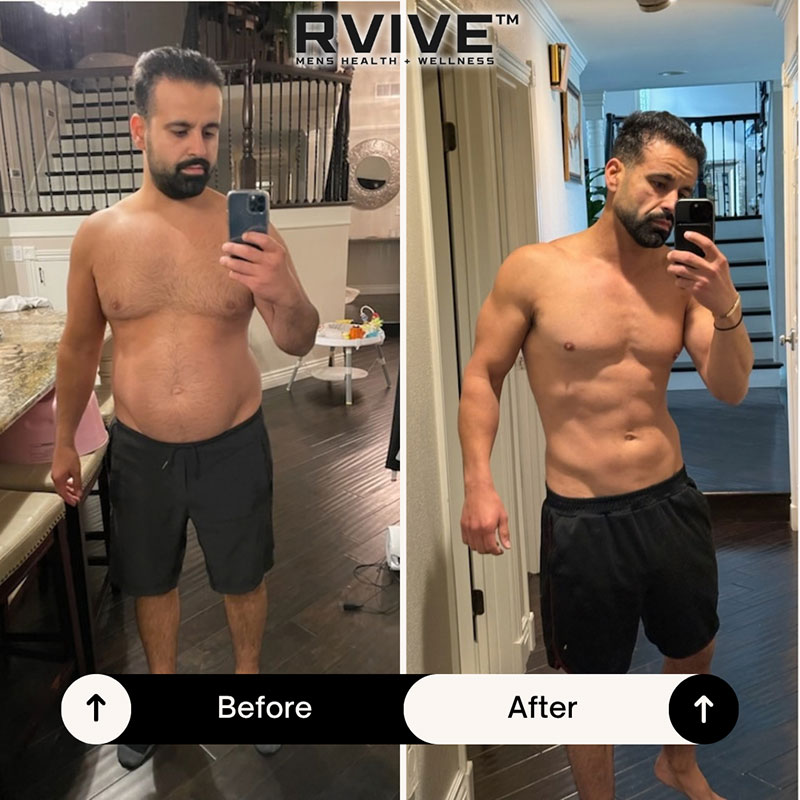 Semaglutide in Rancho Cucamonga
